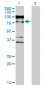 ZNF274 Antibody (monoclonal) (M04)