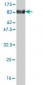 ZNF394 Antibody (monoclonal) (M02)