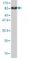 ZNF394 Antibody (monoclonal) (M02)