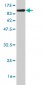 ZNF394 Antibody (monoclonal) (M03)