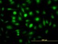 ZWINT Antibody (monoclonal) (M01)