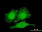 ZYX Antibody (monoclonal) (M01)