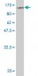 ZYX Antibody (monoclonal) (M02)