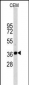 GAPDH Antibody