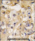 DRAGON (RGMB) Antibody (Center)