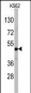 DRAGON (RGMB) Antibody (Center)