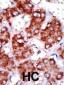 CPT1B Antibody (C-term)