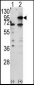 CPT1B Antibody (C-term)
