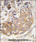 COL9A1 Antibody (Center)