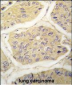 B2M Antibody (N-term)