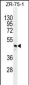 FUT4 Antibody (Center)