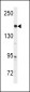 ABL Antibody (Y251)