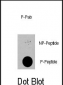 Phospho-PDPK1(S396) Antibody