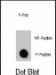 Phospho-TSC2(T1462) Antibody