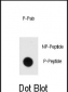 Phospho-MBP(Y203) Antibody