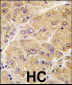 SOST Antibody (Center)