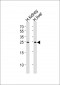 SOST Antibody (Center)