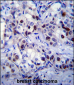 RB1 Antibody (S608)