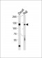 RB1 Antibody (S608)