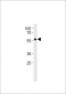 p53 Antibody (S315)