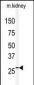 Claudin 2 (CLDN2) Antibody (C-term)