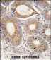 FGF1 Antibody (N-term)