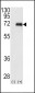 PKC iota Antibody (N-term)