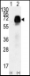 AMHR2 Antibody (N-term R80)