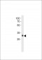 MOX1 (Meox1) Antibody (C-term)