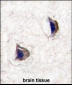 NP1(Nptx1) Antibody (Center)