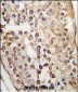 PUM2 Antibody (N-term)