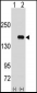 PUM2 Antibody (N-term)