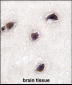 CABP1 Antibody (C-term)