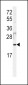 HRAS Antibody (Center)