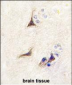 NGFB Antibody (Center)