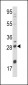 NGFB Antibody (Center)