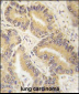 RAF1 Antibody (S339)