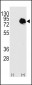 Transglutaminase (TGM2) Antibody (Center T428)