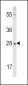 FGF10 Antibody (C-term)