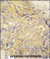 FGF10 Antibody (C-term)