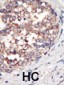 PI3KCG Antibody (C-term)