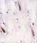 ULK2 Antibody (N-term)