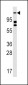 ULK2 Antibody (N-term)