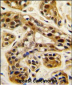 PRMT1 Antibody (C-term K342)