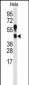 PRMT1 Antibody (C-term K342)