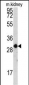 CASP6 Antibody (S257)