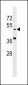 Kremen Antibody (N-term)