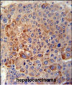 GPLD1 Antibody (C-term)