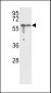 Vimentin Antibody (Center)