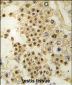 LIN28A Antibody (C-term)